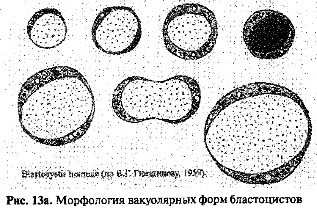 Бластоцисты кал. Микроскопия Blastocystis Hominis. Морфология бластоцист. Бластоцисты вакуолярной формы. Бластоциста микроскопия.